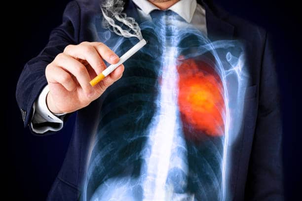 Tobacco