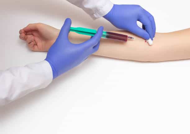 C-Reactive Protein Test Market Competitive Strategies for Future Expansion