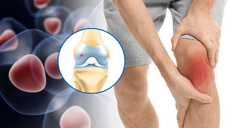 The Cartilage Repair Market Poised for Significant Growth, Projected to Reach USD 3.48 Billion by 2030