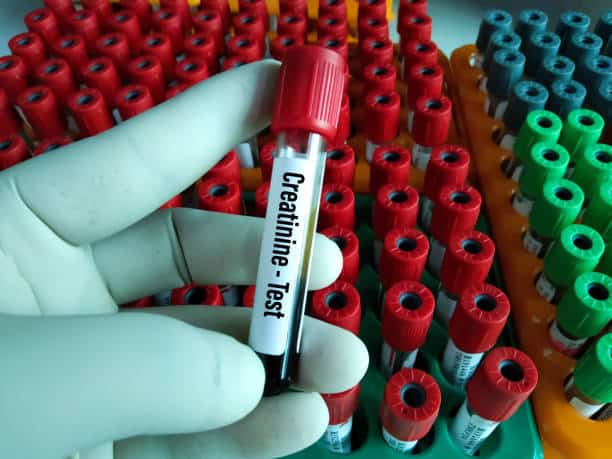 Creatinine Test