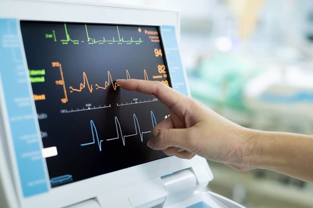 Electrocardiograph (ECG) Market to Reach USD 9 Billion by 2030 with a CAGR of 5%