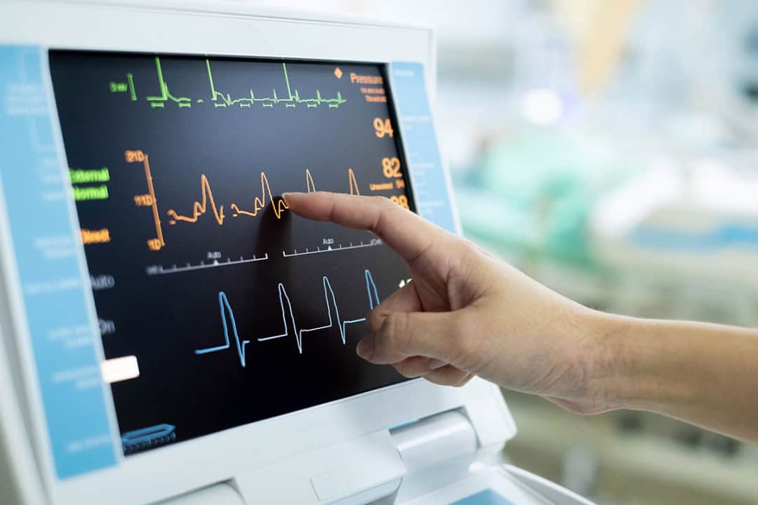 Electrocardiograph (ECG) Market1