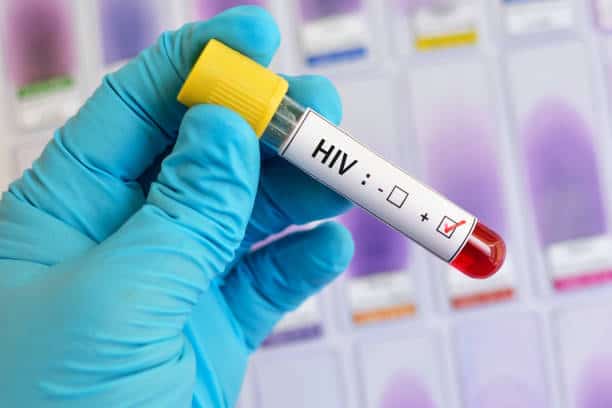 HIV Diagnostics
