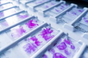 In-situ Hybridization Market
