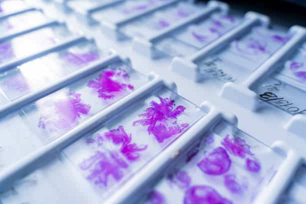In-situ Hybridization Market Study: Comprehensive Segmentation and Forecasting