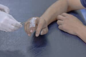 Intramedullary Nails Market