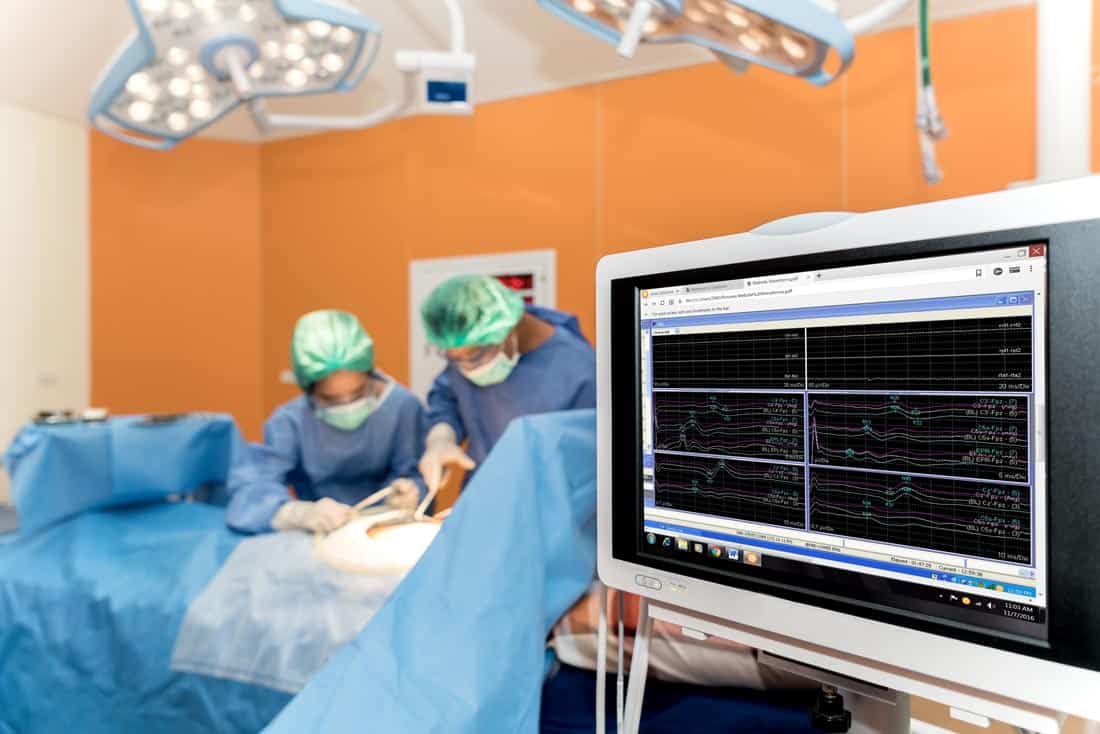 Intraoperative Neuromonitoring 2