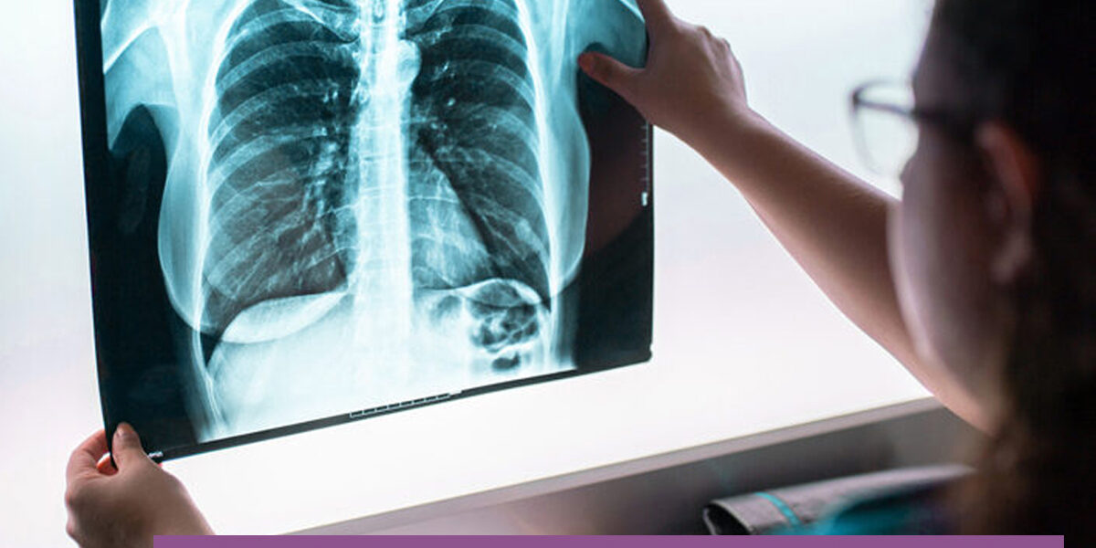 Lung Cancer Diagnostics Market