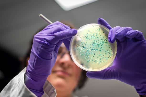 Microbiology Culture Market