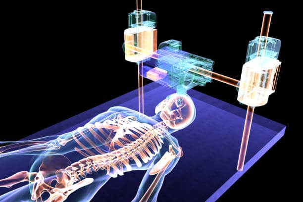 Microfocus X-Ray Sources Market
