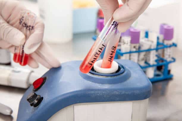 Monoclonal Antibody Diagnostic Reagents