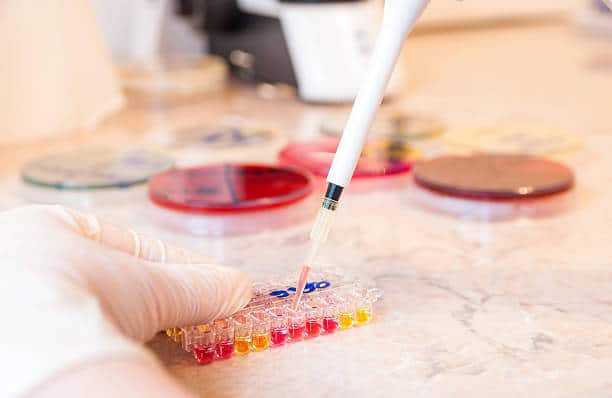 Mycoplasma Testing
