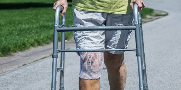 Negative Pressure Wound Therapy