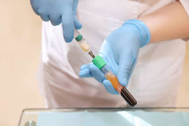 Sample Preparation Systems Market