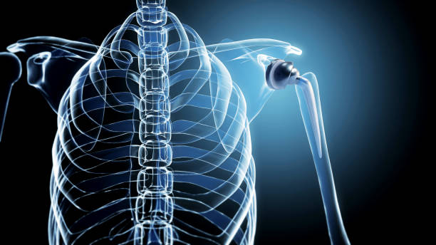 Spinal Implant Market Growth: Strategic Insights and Competitive Landscape