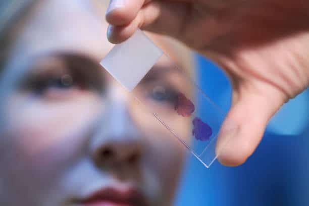 Tissue Diagnostics