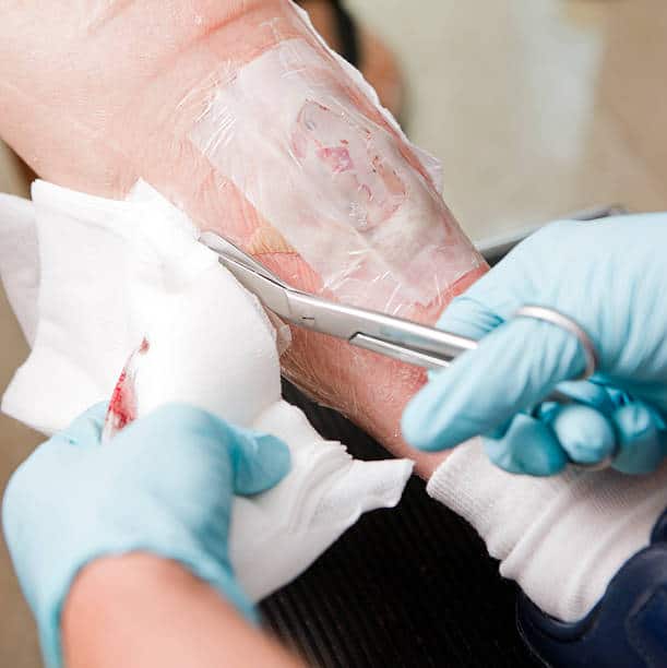 Wound Care Biologics