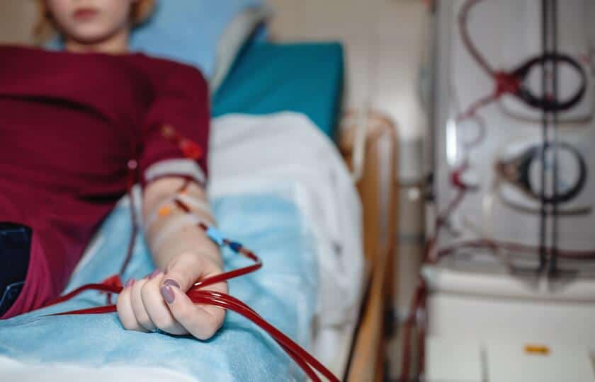 av-fistula (1)