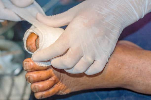Ostomy Products for Permanent Ostomies Market Vision 2035: Decade of Growth in Size and Share