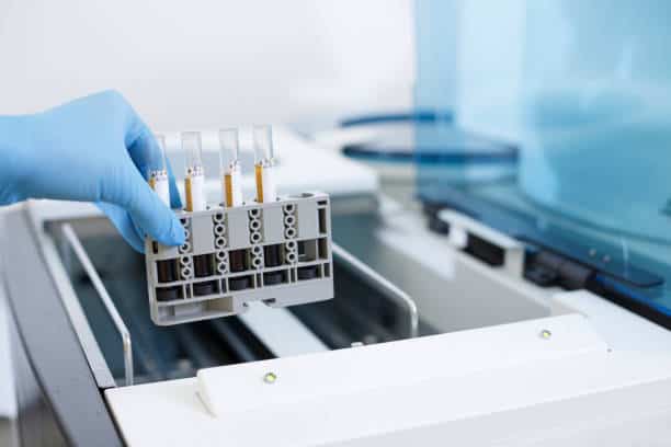 Cell & Gene Therapy Manufacturing Services Market Projections: Decoding Growth and Share Trends to 2035