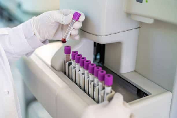 Blood Testing Market Riding the Wave of Global Expansion Through 2034