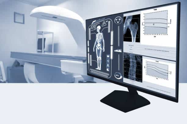 Japan Industrial X-ray Systems and Imaging Software Market Snapshot: The Path to Global Dominance by 2035