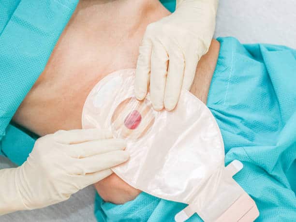 Japan Hydrocellular Dressings Market Riding the Wave of Global Expansion Through 2035