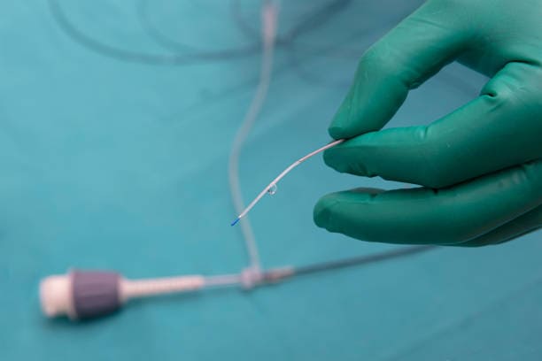 Electrophysiology Catheters Market Trajectories: Insights into the Decade Ahead for Size and Share Growth