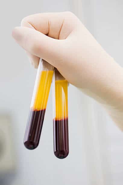 China Blood Cell Separation Market Vision 2035: Decade of Growth in Size and Share