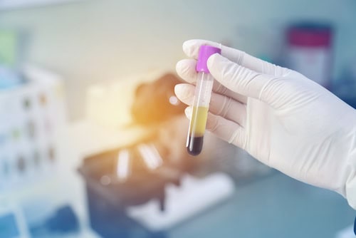 Blood Preparation Market5