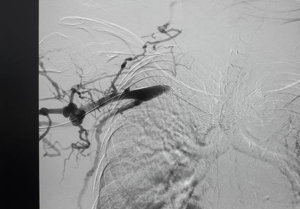 China Iliac Stent Market Outlook: Strategic Growth and Industry Insights