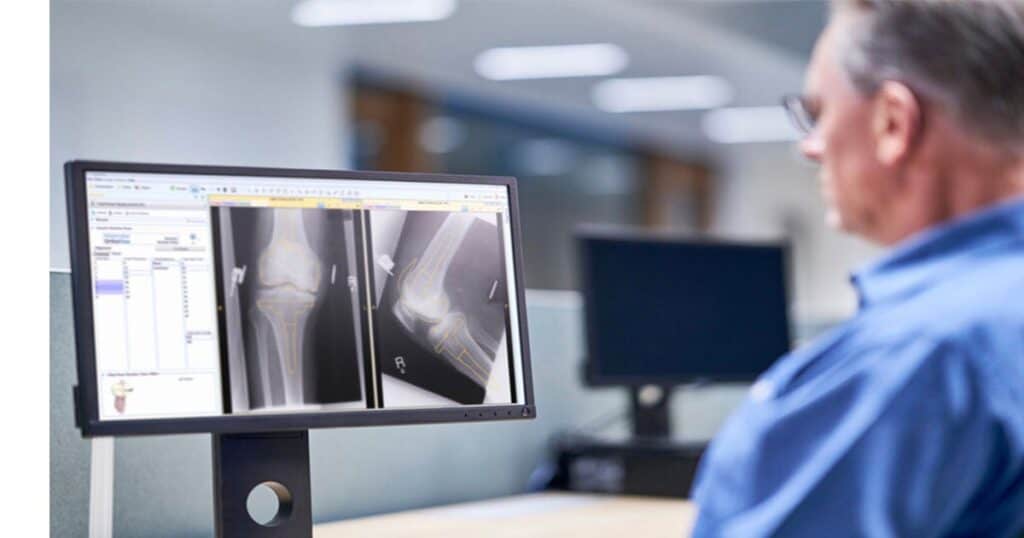 Preoperative Surgical Planning Software Market Projected to Reach USD 149.5 Million by 2030, Growing at a CAGR of 4.7%