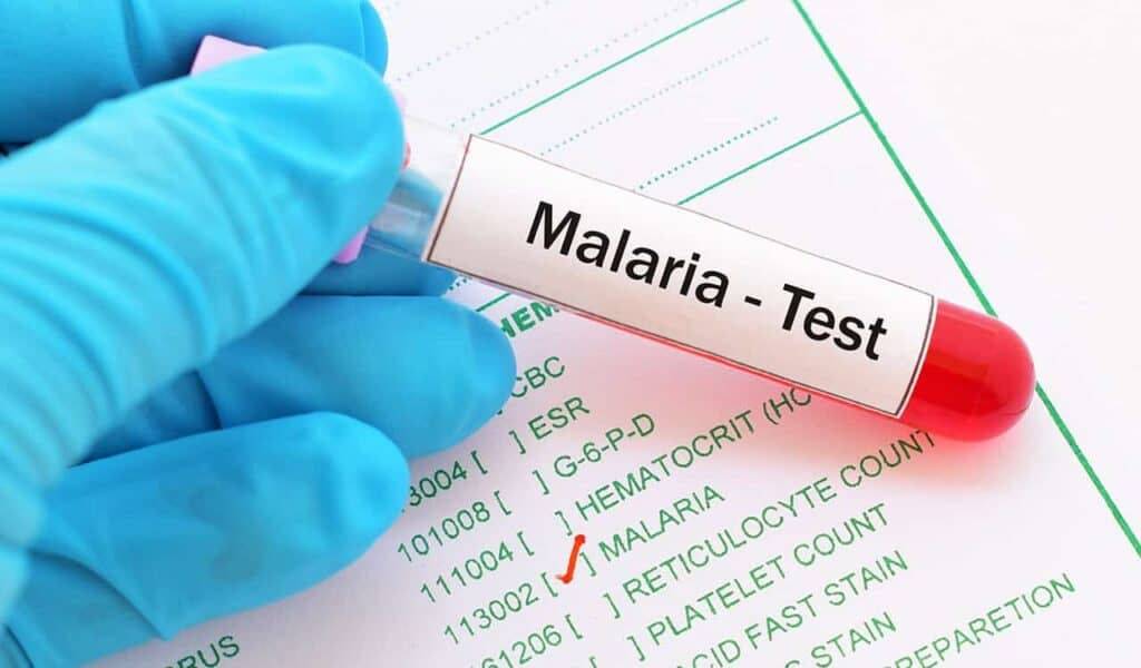Malaria Diagnostics Market Projected to Reach USD 1,197.13 Million by 2030, Growing at a CAGR of 4.8%