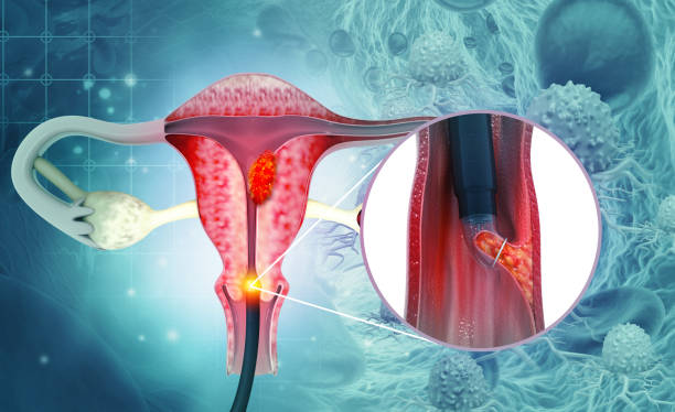 Japan Cervical Cancer Diagnostic Testing Market Size, Share, and Demand Forecast (2025-2035)