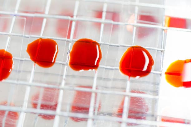 North America Hemodialysis Concentrates Market Strategies: Competitive Insights for Expansion