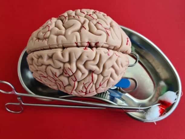 China Deep Brain Stimulation Systems Market : Future Prospects and Industry Analysis (2025-2035)