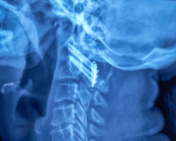 Medical XRay Films Market Size, Share, and Demand Forecast (2025-2035)