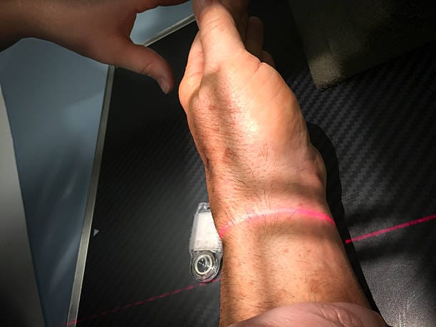 U.S. Muscle Hypertonia Treatment Market Dynamics and Strategic Recommendations for 2025-2037