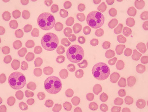 China Acute Lymphocytic/Lymphoblastic Leukemia Therapeutics Market In Focus: Size, Share, and Growth Trends Explored through 2036