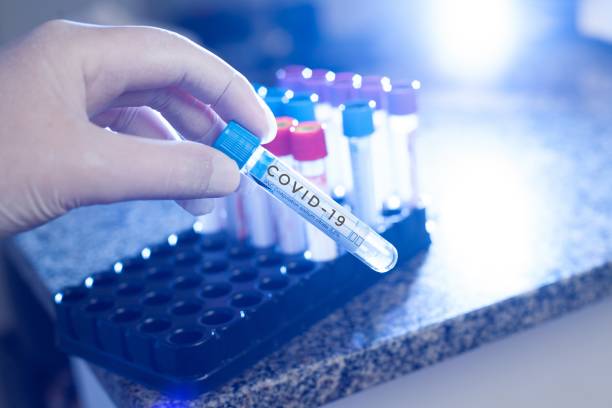 Europe COVID-19 Diagnostics Market Industry at a Crossroads: Recession Threats and the Future of Global Trade
