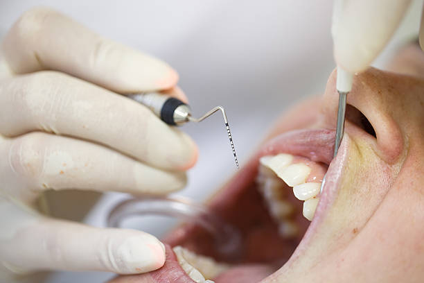 china Periodontal Probes Market Outlook 2025: Forecasting Growth in a Time of Economic and Policy Shifts