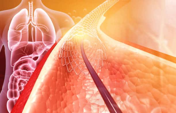 U.S. Transcatheter Mitral Valve Replacement Market Momentum: Size, Share, and Growth Dynamics in 2035