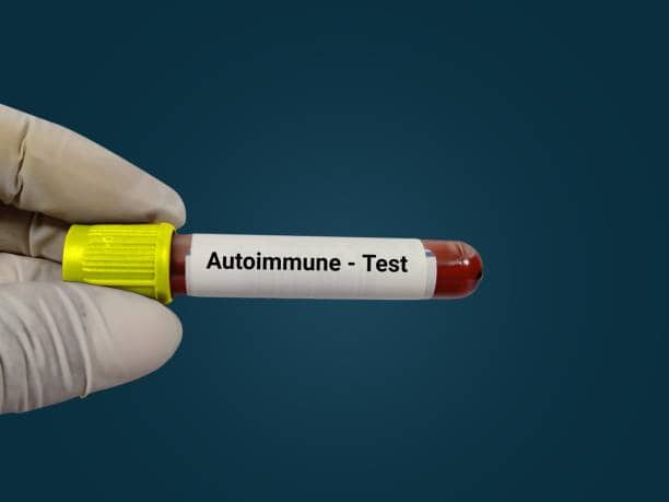 Japan Rheumatic Fever Treatment Market Dynamics and Strategic Recommendations for 2025-2036