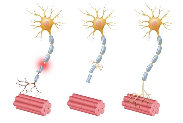 Europe Nerve Repair and ReGeneration Market Report: Comprehensive Overview of Developments