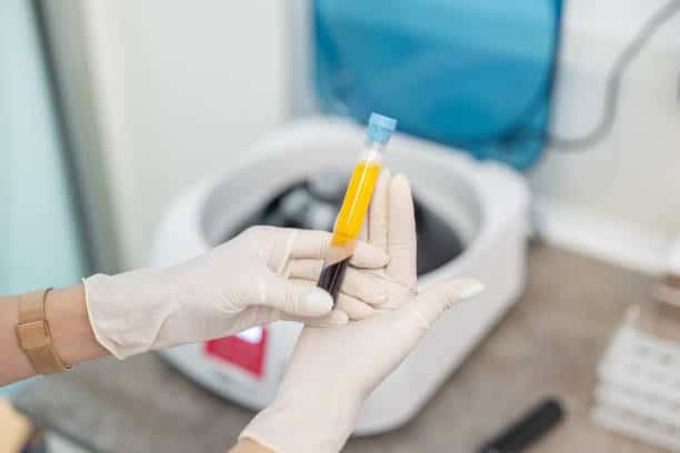 Singapore Platelet Rich Plasma Market Growth Unveiled: Strategic Future Insights