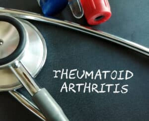Rheumatic Fever Treatment