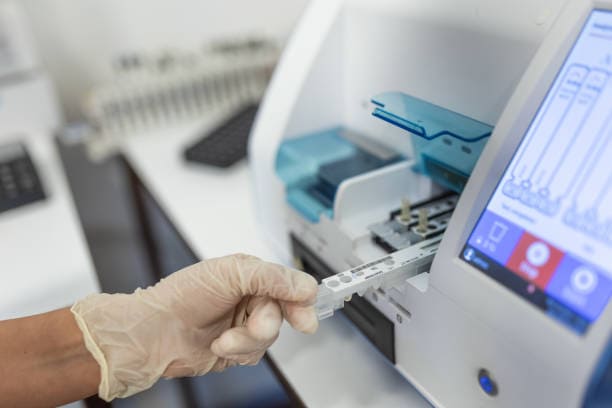China Lateral Flow Reader Market Pathways: Comprehensive Analysis of Size, Share, and Growth Trends until 2035