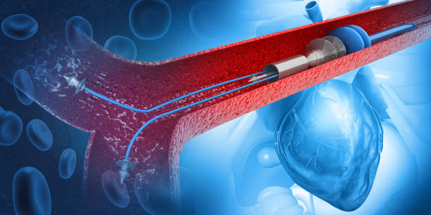 U.S. Cryoablation Devices Market Momentum: Size, Share, and Growth Dynamics in 2035