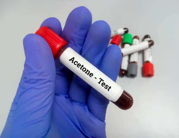 Saudi Arabia Acetone Market Dynamics: Regional Breakdown and Analysis