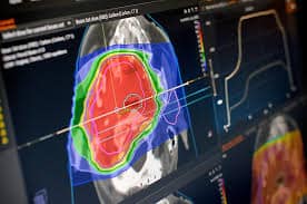 Radiation Treatment Planning Solutions Market Market Report Forecasts Dynamic Growth Through 2035